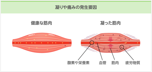 肩こりのメカニズム その2